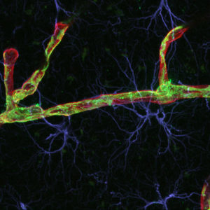 Immunohistochemistry photo taken on a confocal microscope: pericytes (green), astrocytes (blue), and blood vessel (endothelial cells- red) are labelled with fluorescent antibodies.