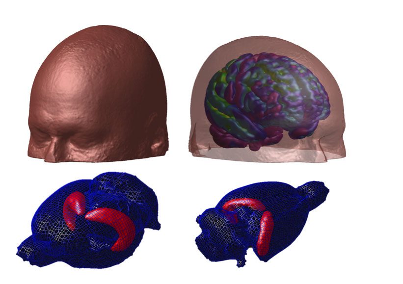 Ces images ont été créées par le laboratoire du Dr RosaNeto à l'Hôpital Douglas de l'Université McGill et montrent la fusion entre l'anatomie du cerveau et le dépôt d'amyloïde dans le cerveau humain vivant (rangée du haut) et dans celui du rat (rangée du bas).